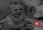 Standbild Kinder mit Haut Infektionen Deutschland, 1946, aus Sekunde 9 historischem Filmmaterial Videoclip 65675056080