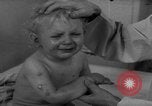 Standbild Kinder mit Haut Infektionen Deutschland, 1946, aus Sekunde 10 historischem Filmmaterial Videoclip 65675056080