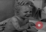 Standbild Kinder mit Haut Infektionen Deutschland, 1946, aus Sekunde 11 historischem Filmmaterial Videoclip 65675056080