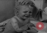 Standbild Kinder mit Haut Infektionen Deutschland, 1946, aus Sekunde 12 historischem Filmmaterial Videoclip 65675056080