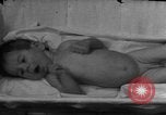 Standbild Kinder mit Haut Infektionen Deutschland, 1946, aus Sekunde 60 historischem Filmmaterial Videoclip 65675056080