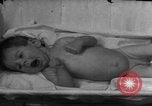 Standbild Kinder mit Haut Infektionen Deutschland, 1946, aus Sekunde 61 historischem Filmmaterial Videoclip 65675056080
