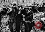 Standbild Wunden und medizinische Behandlung von US-Soldaten Pacific Theater, 1944, aus Sekunde 6 historischem Filmmaterial Videoclip 65675056748