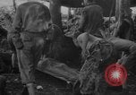 Standbild Wunden und medizinische Behandlung von US-Soldaten Pacific Theater, 1944, aus Sekunde 25 historischem Filmmaterial Videoclip 65675056748