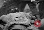 Standbild Wunden und medizinische Behandlung von US-Soldaten Pacific Theater, 1944, aus Sekunde 50 historischem Filmmaterial Videoclip 65675056748
