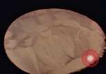 Immagine di Intervento di medicina Shanghai in Cina, 1972, secondo 54 filmato di repertorio 65675057348