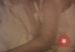 Immagine di Intervento di medicina Shanghai in Cina, 1972, secondo 62 filmato di repertorio 65675057348