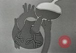 Image of artificial heart United States USA, 1966, second 44 stock footage video 65675058302