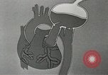 Image of artificial heart United States USA, 1966, second 45 stock footage video 65675058302