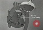 Image of artificial heart United States USA, 1966, second 48 stock footage video 65675058302