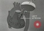 Image of artificial heart United States USA, 1966, second 49 stock footage video 65675058302