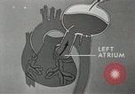 Image of artificial heart United States USA, 1966, second 50 stock footage video 65675058302