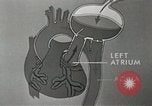 Image of artificial heart United States USA, 1966, second 51 stock footage video 65675058302
