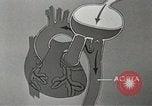 Image of artificial heart United States USA, 1966, second 52 stock footage video 65675058302