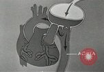Image of artificial heart United States USA, 1966, second 53 stock footage video 65675058302