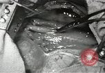 Image of artificial heart United States USA, 1966, second 59 stock footage video 65675058302