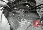 Image of artificial heart United States USA, 1966, second 61 stock footage video 65675058302