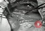 Image of artificial heart United States USA, 1966, second 62 stock footage video 65675058302