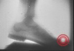 Image of X ray machine Paris France, 1935, second 27 stock footage video 65675058974