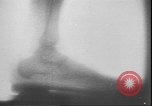 Image of X ray machine Paris France, 1935, second 28 stock footage video 65675058974