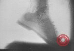 Image of X ray machine Paris France, 1935, second 29 stock footage video 65675058974