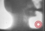 Image of X ray machine Paris France, 1935, second 40 stock footage video 65675058974