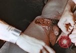 Image of wounded Marines Pacific Ocean, 1945, second 10 stock footage video 65675059750