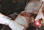 Image of wounded Marines Pacific Ocean, 1945, second 12 stock footage video 65675059750