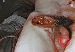 Image of wounded Marines Pacific Ocean, 1945, second 18 stock footage video 65675059750