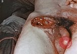 Image of wounded Marines Pacific Ocean, 1945, second 19 stock footage video 65675059750