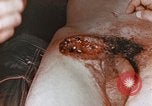 Image of wounded Marines Pacific Ocean, 1945, second 20 stock footage video 65675059750