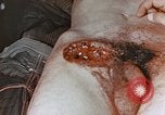 Image of wounded Marines Pacific Ocean, 1945, second 21 stock footage video 65675059750