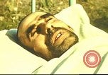 Standbild italienischen Patienten Neapel Italien, 1944, aus Sekunde 11 historischem Filmmaterial Videoclip 65675060292