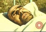 Standbild italienischen Patienten Neapel Italien, 1944, aus Sekunde 12 historischem Filmmaterial Videoclip 65675060292