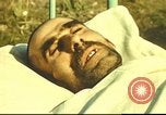 Standbild italienischen Patienten Neapel Italien, 1944, aus Sekunde 14 historischem Filmmaterial Videoclip 65675060292