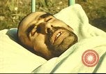 Standbild italienischen Patienten Neapel Italien, 1944, aus Sekunde 15 historischem Filmmaterial Videoclip 65675060292