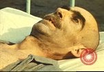 Standbild italienischen Patienten Neapel Italien, 1944, aus Sekunde 30 historischem Filmmaterial Videoclip 65675060292