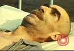 Standbild italienischen Patienten Neapel Italien, 1944, aus Sekunde 31 historischem Filmmaterial Videoclip 65675060292
