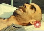 Standbild italienischen Patienten Neapel Italien, 1944, aus Sekunde 35 historischem Filmmaterial Videoclip 65675060292