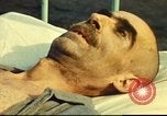 Standbild italienischen Patienten Neapel Italien, 1944, aus Sekunde 36 historischem Filmmaterial Videoclip 65675060292