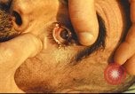 Standbild italienischen Patienten Neapel Italien, 1944, aus Sekunde 58 historischem Filmmaterial Videoclip 65675060292