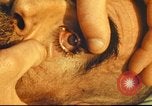 Standbild italienischen Patienten Neapel Italien, 1944, aus Sekunde 61 historischem Filmmaterial Videoclip 65675060292