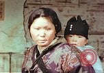 Image of burn wounds from atomic bomb Hiroshima Japan, 1946, second 16 stock footage video 65675060683