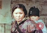 Image of burn wounds from atomic bomb Hiroshima Japan, 1946, second 18 stock footage video 65675060683