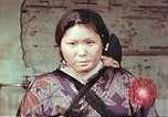 Image of burn wounds from atomic bomb Hiroshima Japan, 1946, second 20 stock footage video 65675060683
