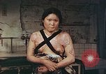 Image of burn wounds from atomic bomb Hiroshima Japan, 1946, second 32 stock footage video 65675060683