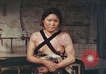 Image of burn wounds from atomic bomb Hiroshima Japan, 1946, second 33 stock footage video 65675060683
