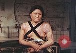 Image of burn wounds from atomic bomb Hiroshima Japan, 1946, second 34 stock footage video 65675060683