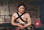 Image of burn wounds from atomic bomb Hiroshima Japan, 1946, second 35 stock footage video 65675060683
