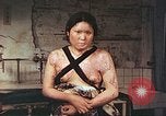Image of burn wounds from atomic bomb Hiroshima Japan, 1946, second 36 stock footage video 65675060683